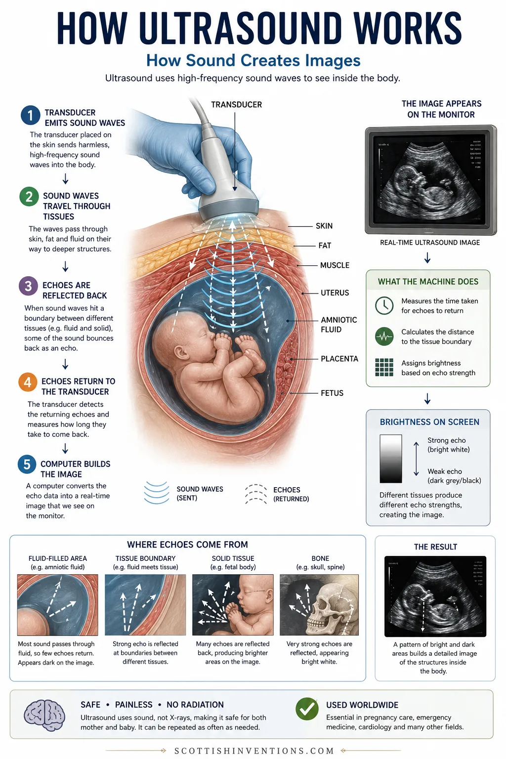 How ultrasound creates an image from echoes Diagram explaining how ultrasound uses sound waves and echoes to create medical images.